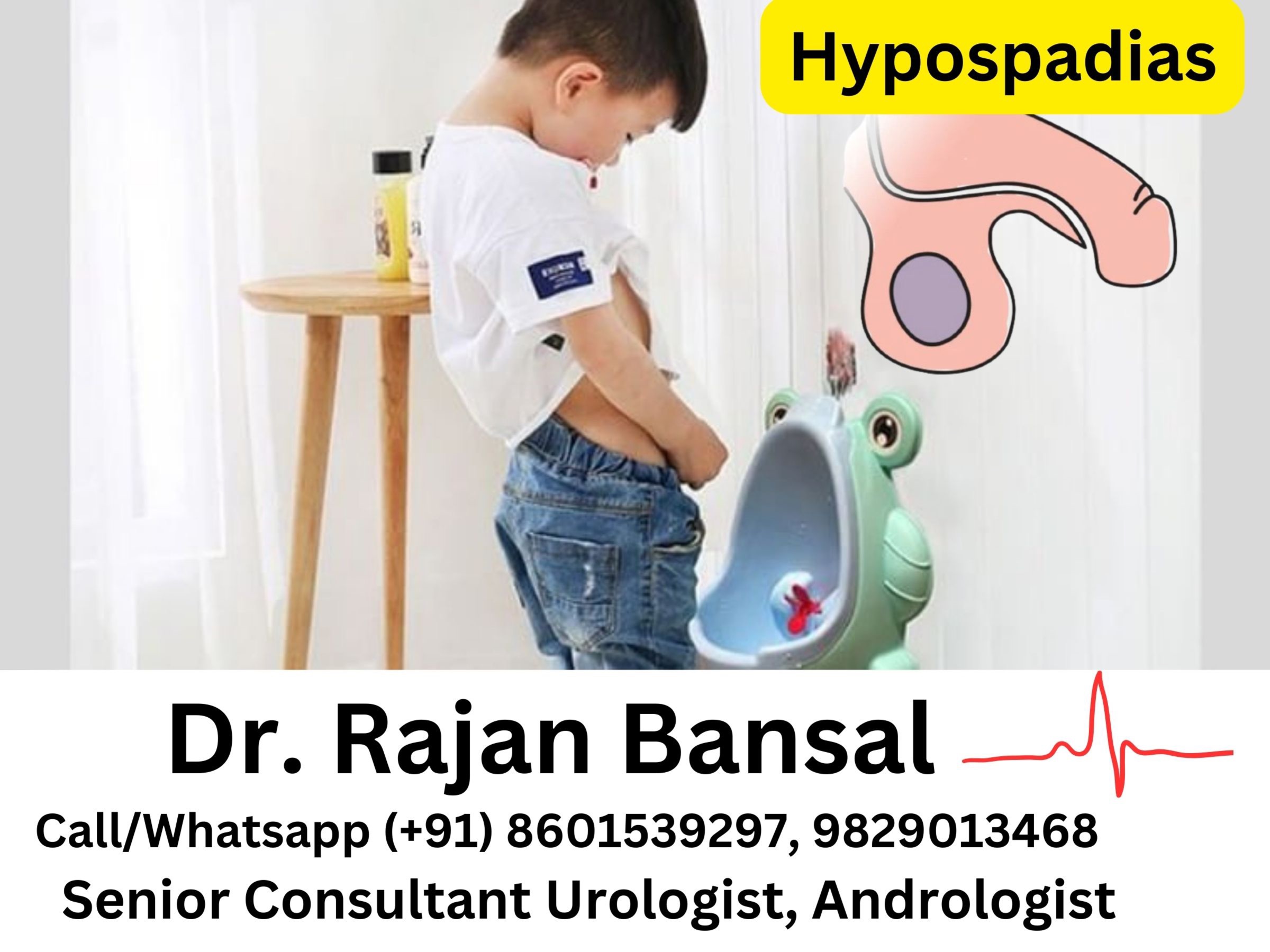 Hypospadias Treatment Jaipur Rajasthan Dr Rajan Bansal Dr M Roychowdhury Best doctor urologist