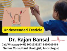 Undescended Testicle best urology doctor Treatment surgery Dr Rajan Bansal Jaipur Rajasthan India