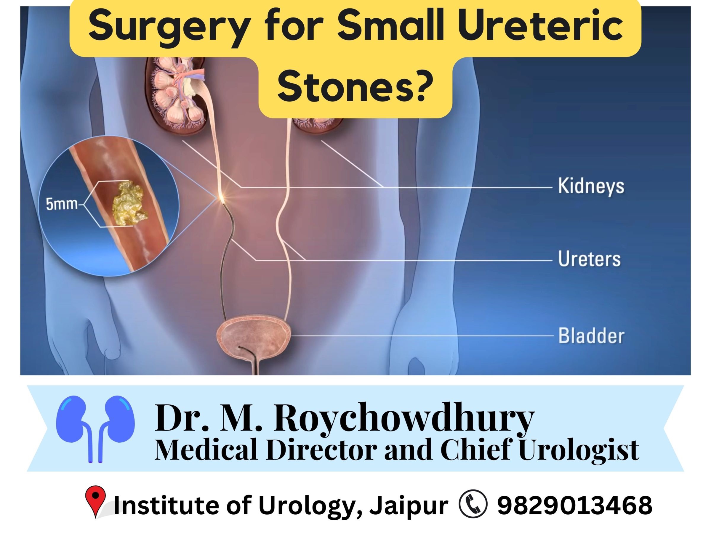 Surgery for Small Ureteric Stones Dr. M Roychowdhury Dr. Rajan Bansal Insitute of Urology C Scheme Jaipur