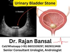 Urinary Bladder Stone Treatment Jaipur Dr Rajan Bansal Urologist C Scheme