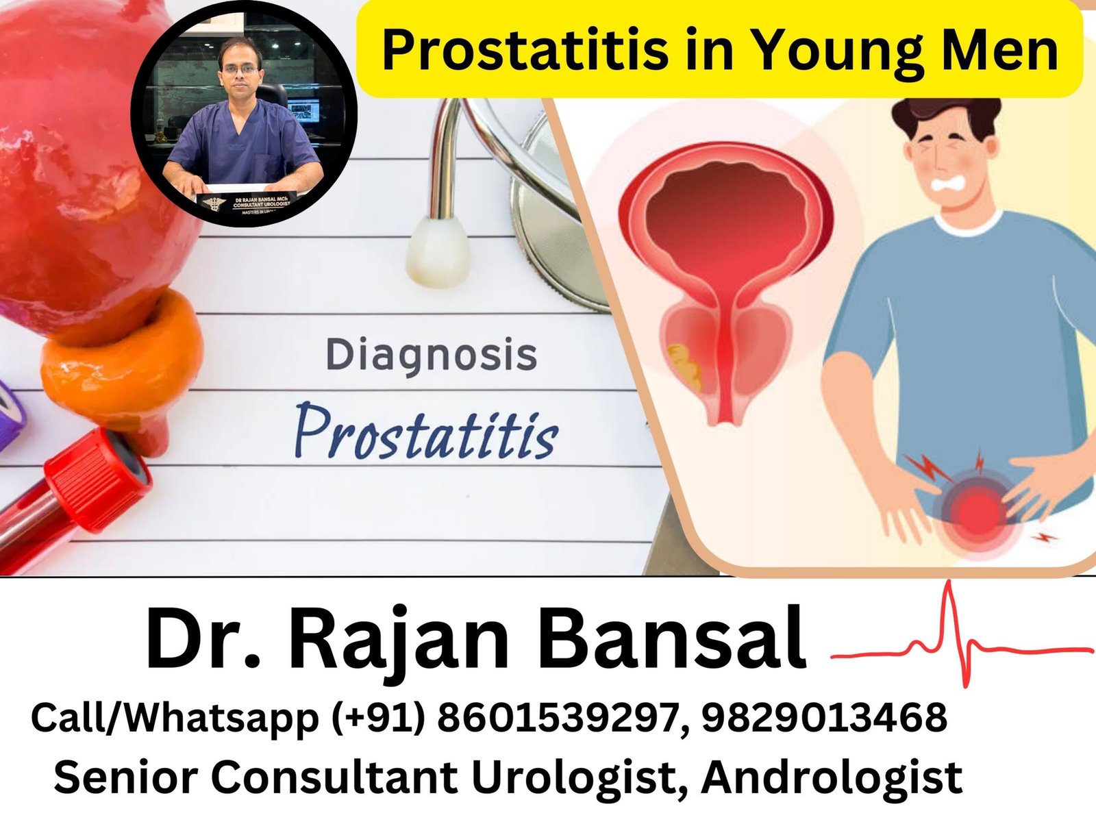 Prostatitis in Young Men Dr Rajan Bansal Dr M Roychowdhury