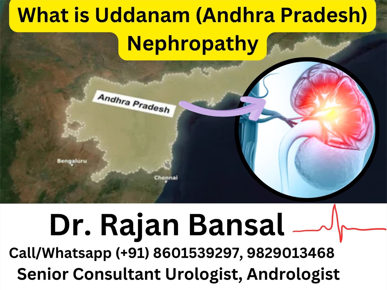 What is Uddanam (Andhra Pradesh) Nephropathy — and why does this region have so much chronic kidney disease? Dr Rajan Bansal What is Uddanam (Andhra Pradesh) Nephropathy — and why does this region have so much chronic kidney disease? Dr Rajan Bansal