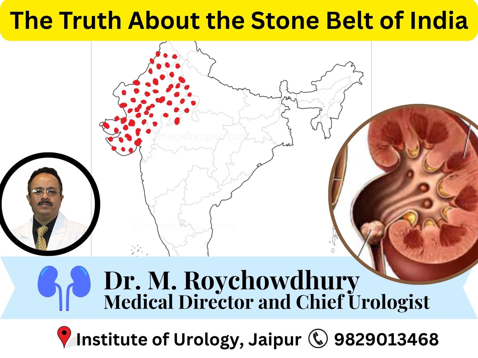 Why Are Kidney Stones Most Prevalent in Rajasthan, Gujarat and Punjab? The Truth About the Stone Belt of India