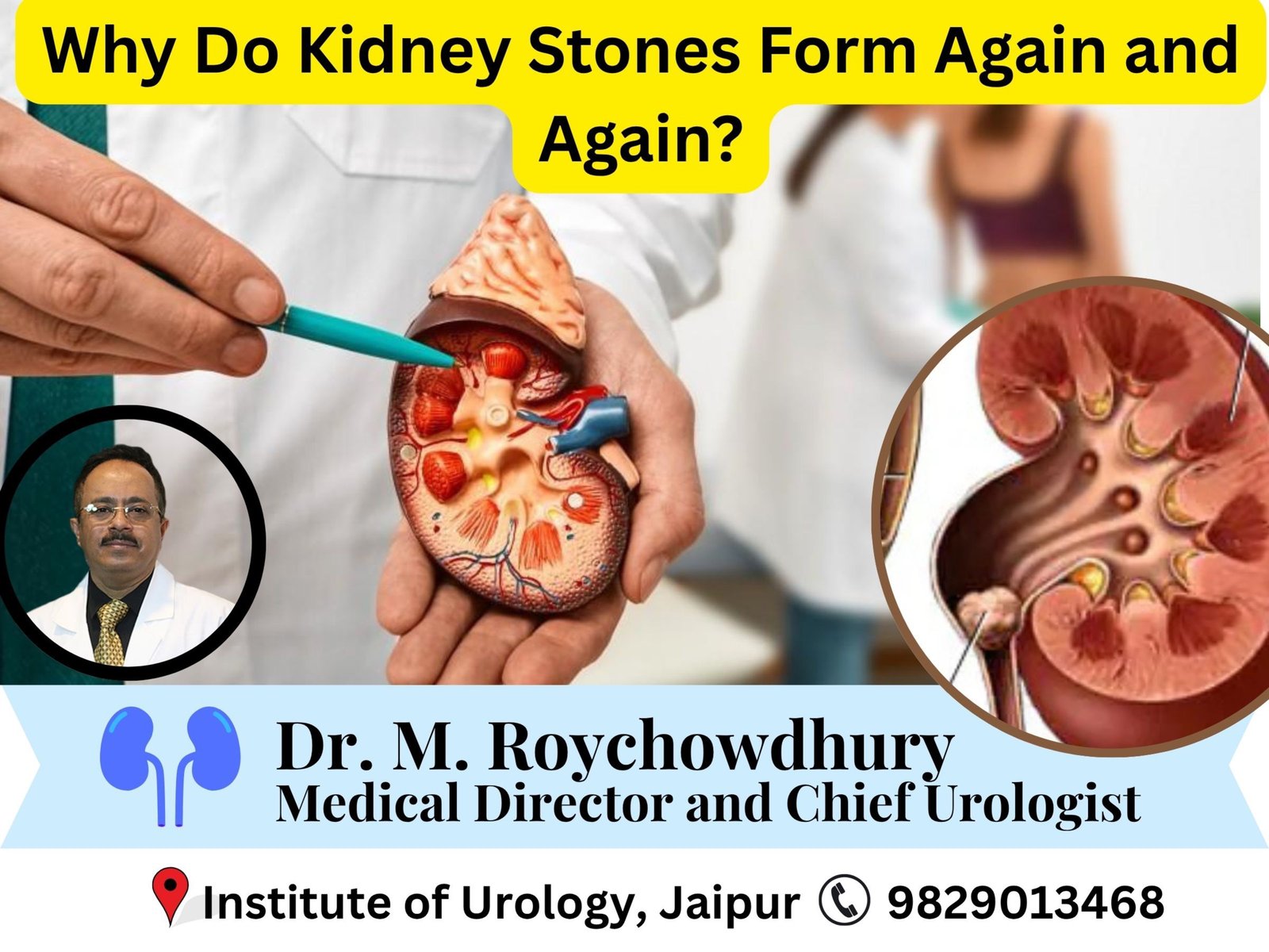 Why Do Kidney Stones Form Again and Again? Prevention Tips That Work Dr M Roychowdhury Dr Rajan Bansal Why Do Kidney Stones Form Again and Again? Prevention Tips That Work Dr M Roychowdhury Dr Rajan Bansal