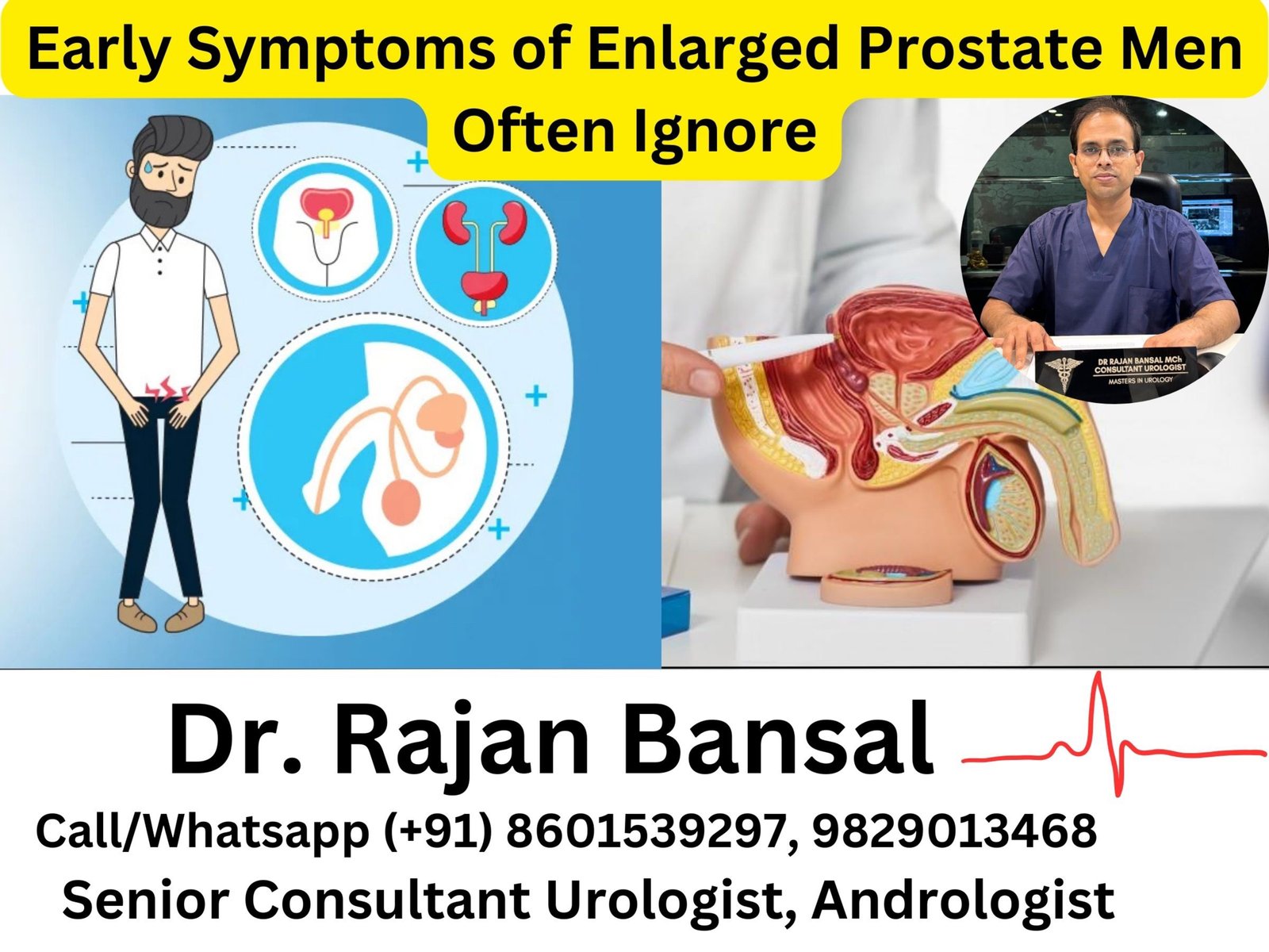 Early Symptoms of Enlarged Prostate Men Often Ignore Dr M roychowdhury Dr Rajan Bansal