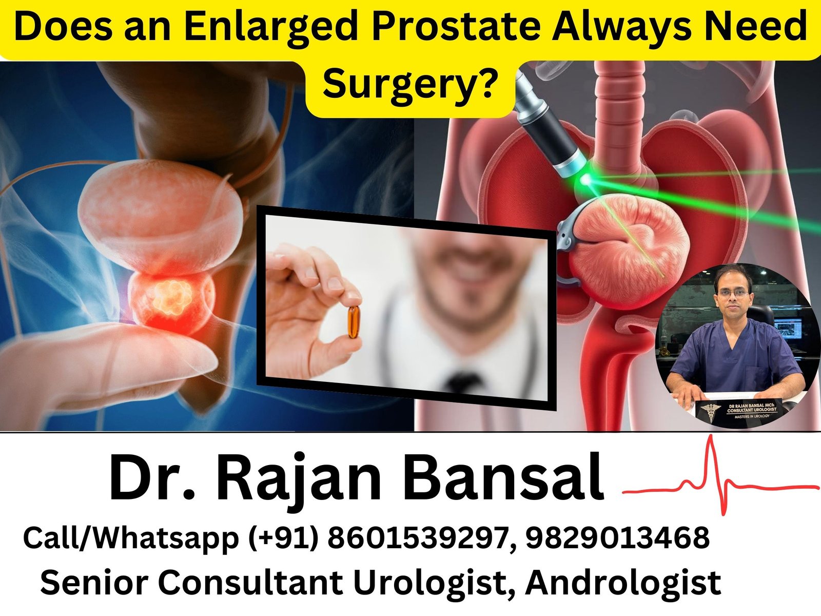 Does an Enlarged Prostate Always Need Surgery? Honest Medical Answer Dr rajan Bansal dr m roychowdhury Does an Enlarged Prostate Always Need Surgery? Honest Medical Answer Dr rajan Bansal dr m roychowdhury