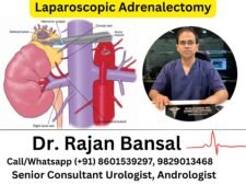Laparoscopic Adrenalectomy Dr Rajan Bansal Dr M Roychowdhury