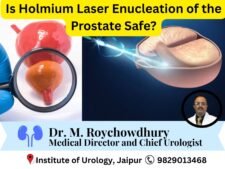 Laser Surgery for Prostate – Is Holmium Laser Enucleation of the Prostate Safe?