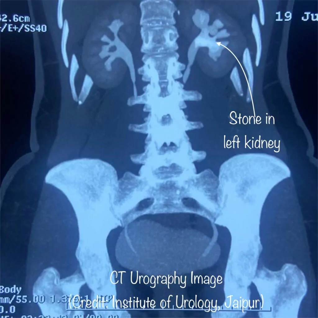 CT urography Dr Rajan Bansal