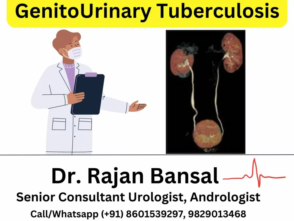 GenitoUrinary Tuberculosis - GUTB Treatment by Dr. Rajan Bansal Jaipur, Rajasthan