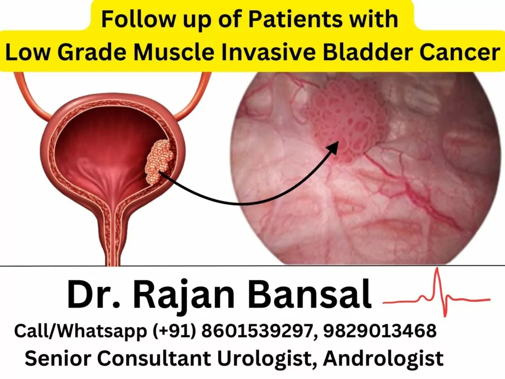 Low-Grade Non-Muscle Invasive Bladder Cancer (NMIBC) Treatment Best Doctor Jaipur Rajasthan Dr. M Roychowdhury Dr. Rajan Bansal
