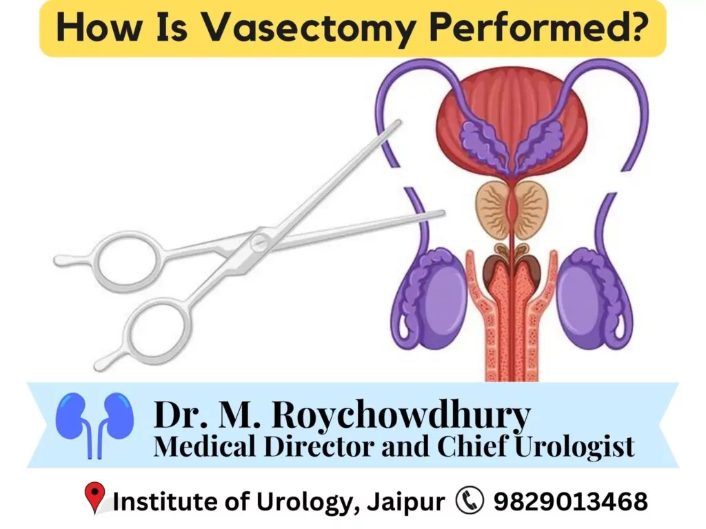 How Is Vasectomy Performed? Dr M Roychowdhury Dr Rajan Bansal Urologist