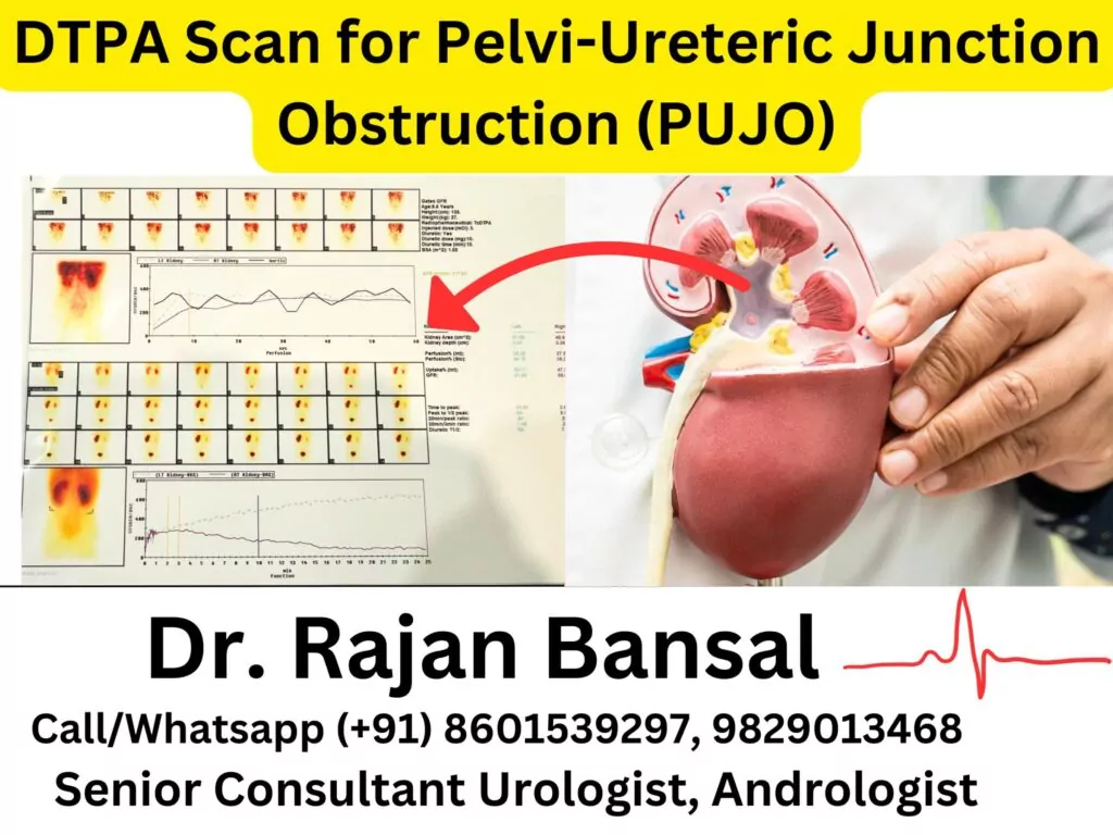 DTPA Scan for Pelvi-Ureteric Junction Obstruction (PUJO) Dr Rajan Bansal Dr M Roychowdhury Best Urologist in Jaipur Rajasthan