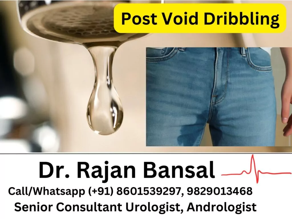 Post Void Dribbling - Causes and Treatment Dr M Roychowdhury Dr Rajan Bansal