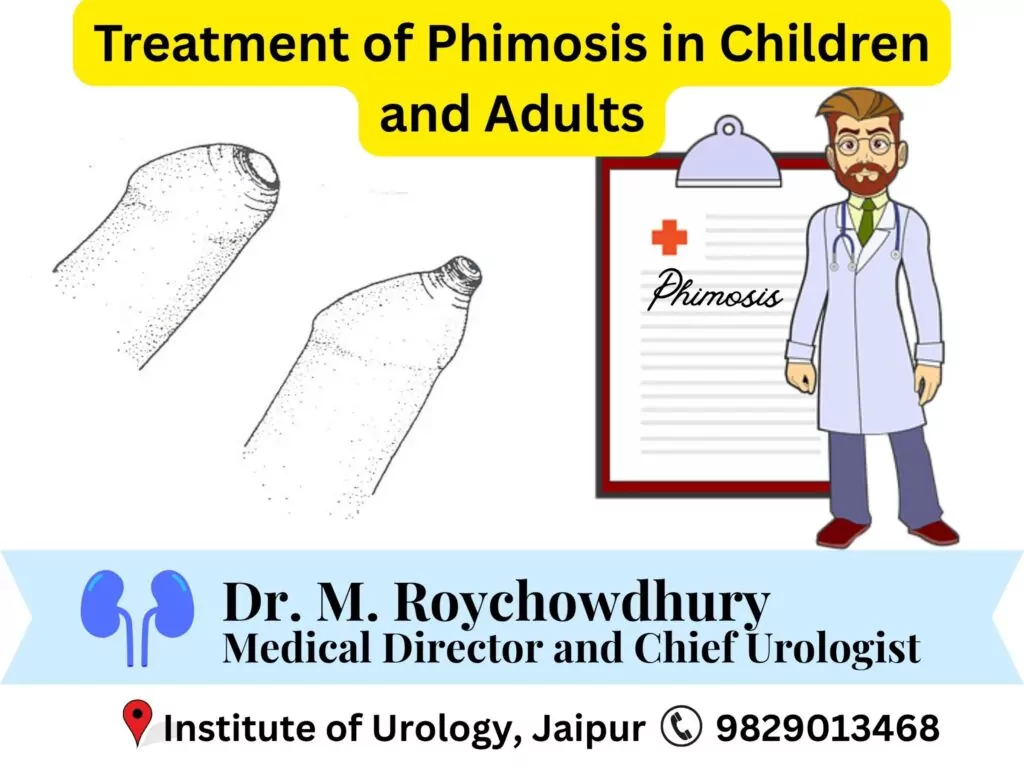 What is the Treatment of Phimosis in Children and Adults? What Are the Latest Ways of Treating Tight Foreskin? Dr M Roychowdhury Dr Rajan Bansal