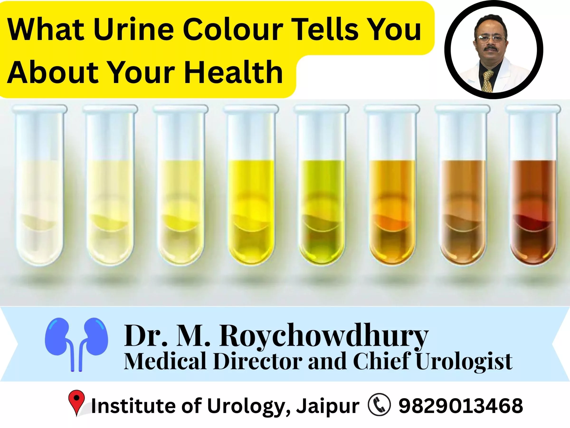 What Urine Colour Tells You About Your Health - Institute of Urology, Jaipur Explains Dr M Roychowdhury Dr Rajan Bansal What Urine Colour Tells You About Your Health - Institute of Urology, Jaipur Explains Dr M Roychowdhury Dr Rajan Bansal