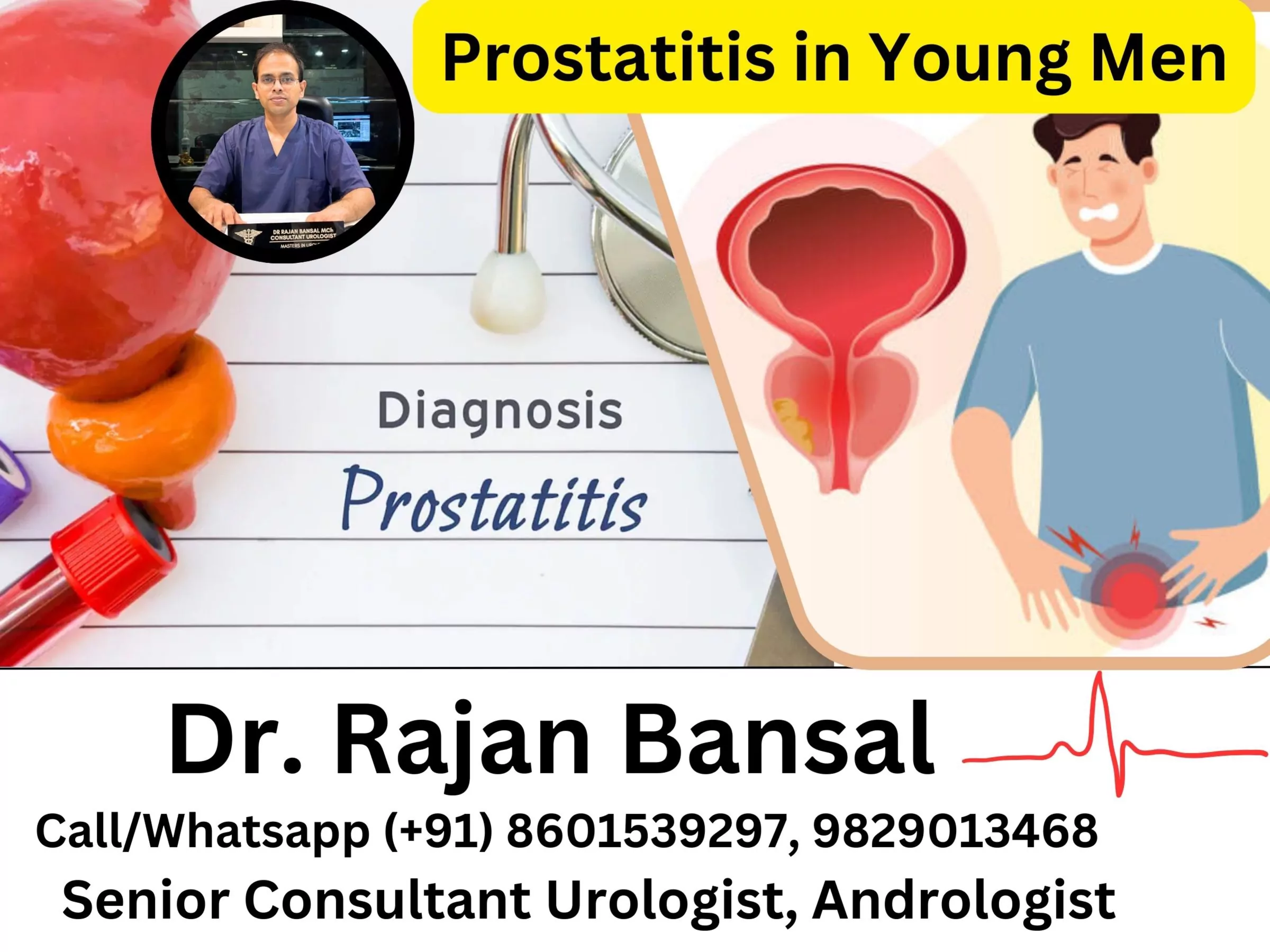 Prostatitis in Young Men Dr Rajan Bansal Dr M Roychowdhury Prostatitis in Young Men Dr Rajan Bansal Dr M Roychowdhury