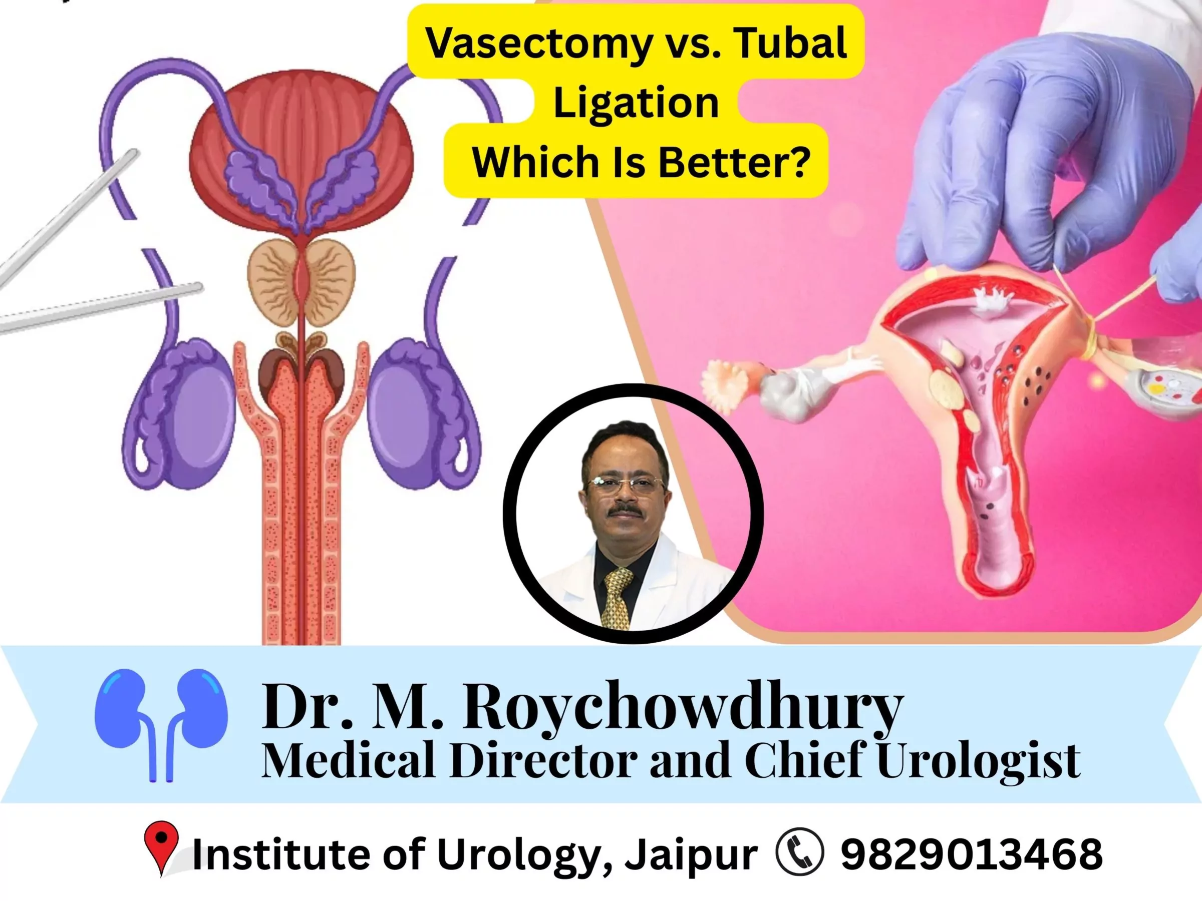 Vasectomy vs. Tubal Ligation (Tubectomy)- Which Is Better? Dr M Roychowdhury Dr Rajan Bansal