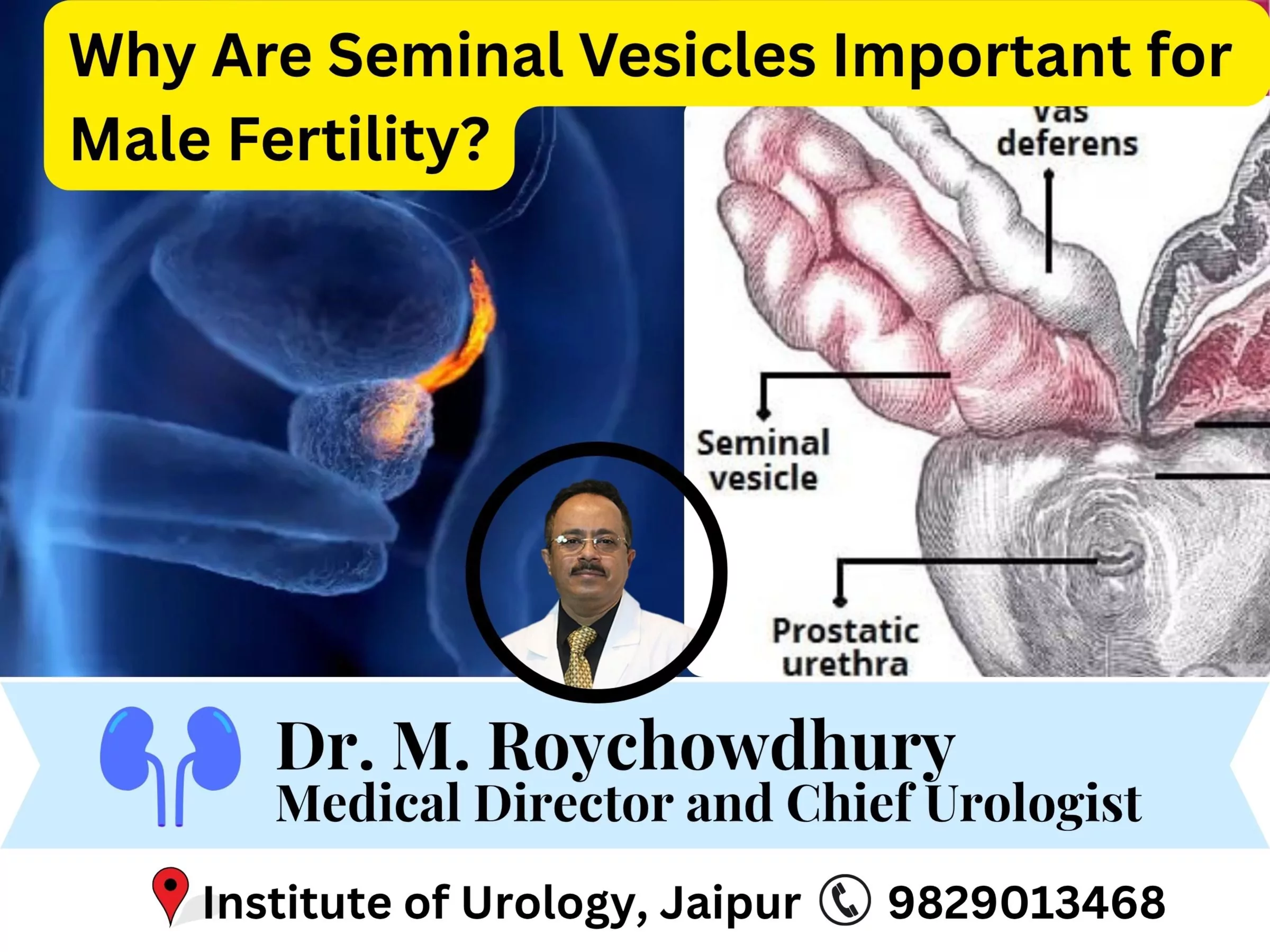 What Are Seminal Vesicles and Why Are They Important for Male Fertility? Dr M Roychowdhury