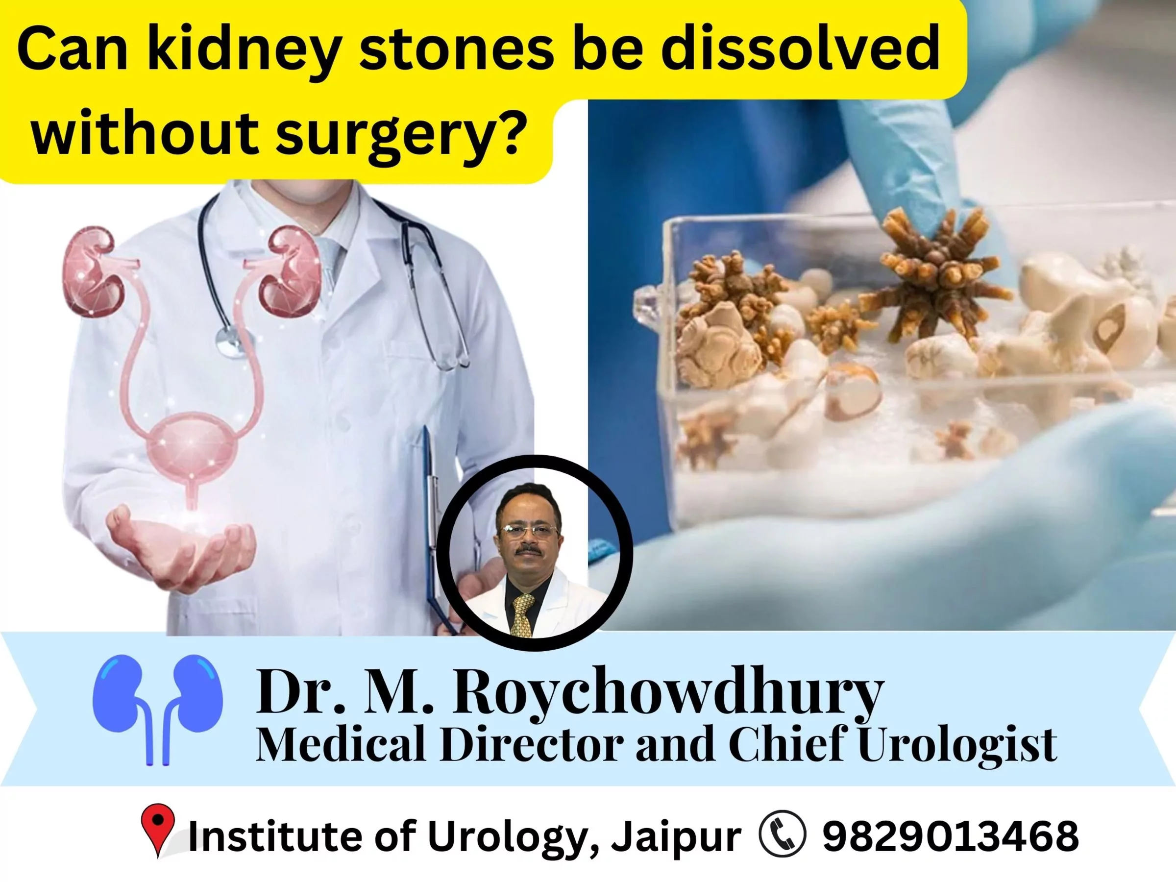 Can kidney stones be dissolved without surgery? Dr M Roychowdhury Dr Rajan Bansal
