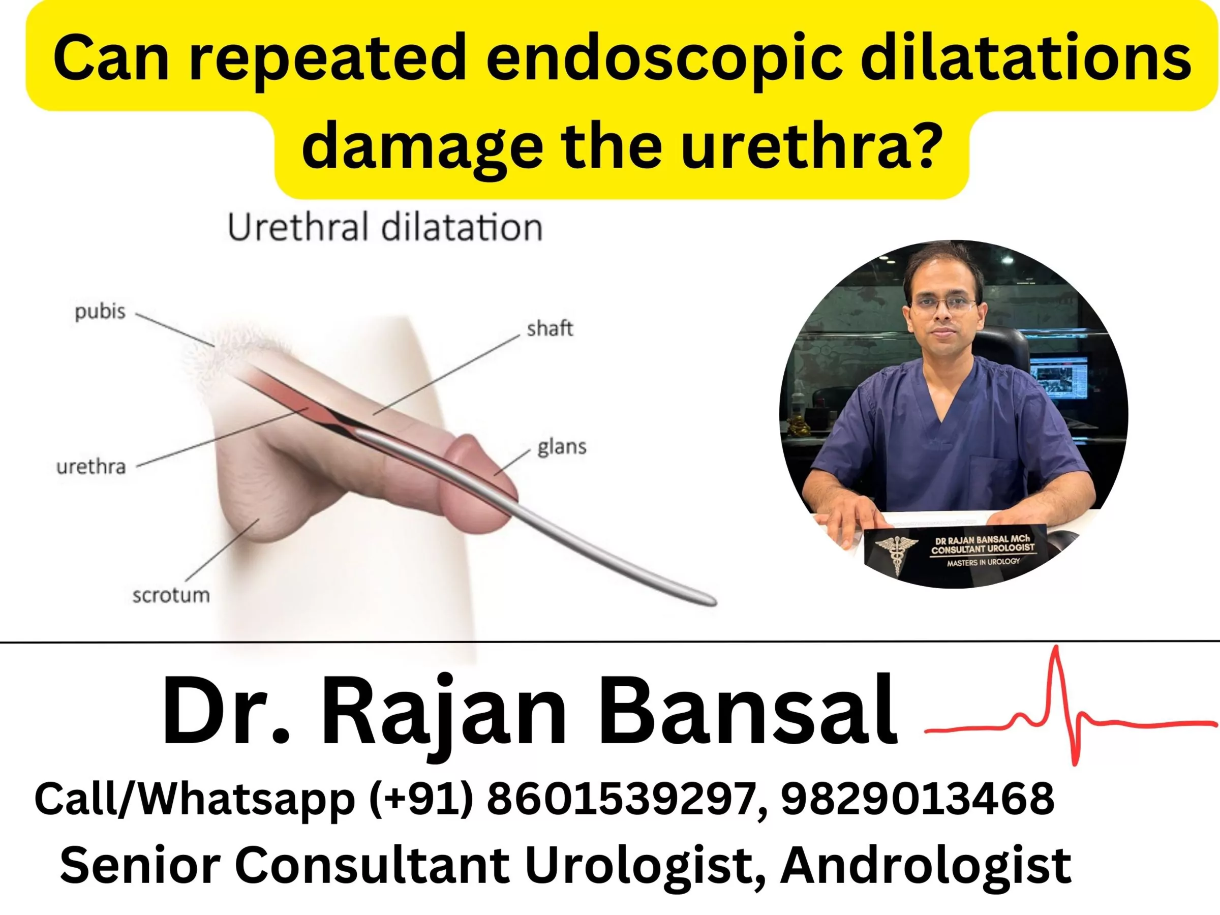 Can repeated endoscopic dilatations damage the urethra? dr rajan bansal dr m roychowdhury