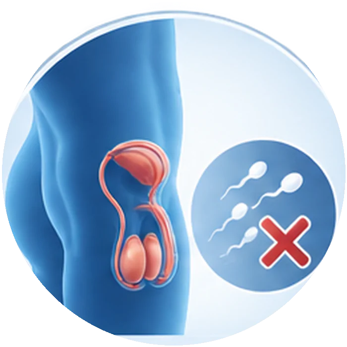 Male Infertility