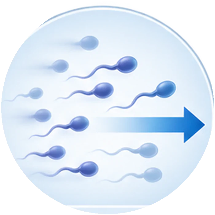 poor sperm movement
